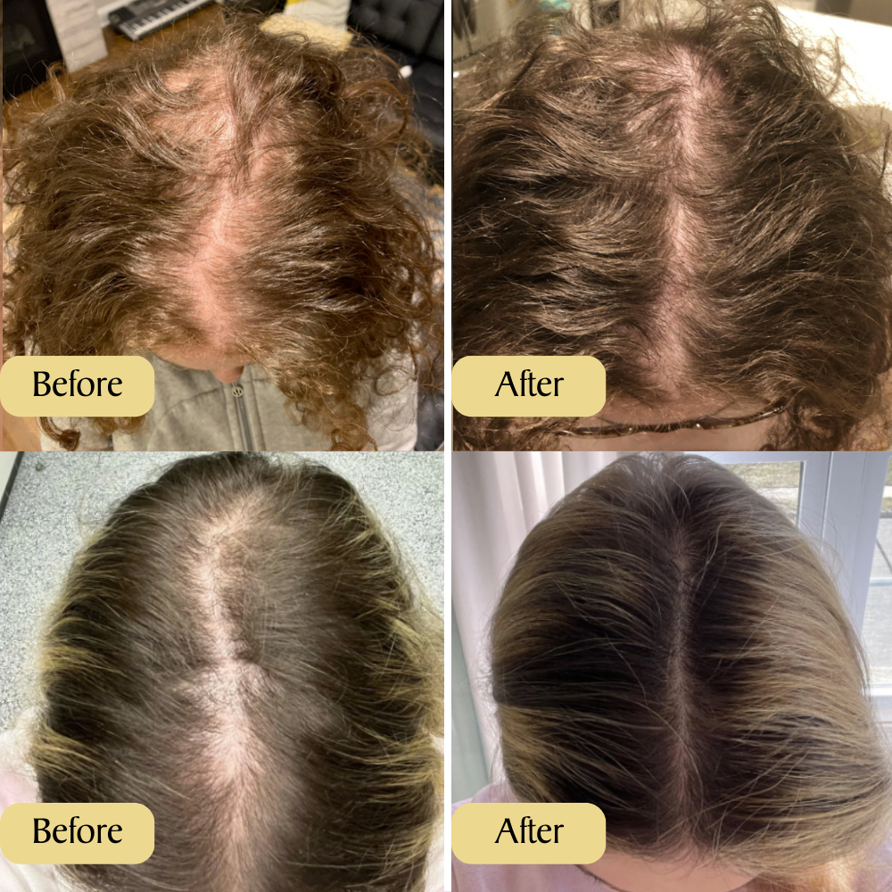 PUREGROW™ Vegan Hair Oil